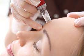 آموزش microneedling trainingمیکرونیدلینگ در کرج 